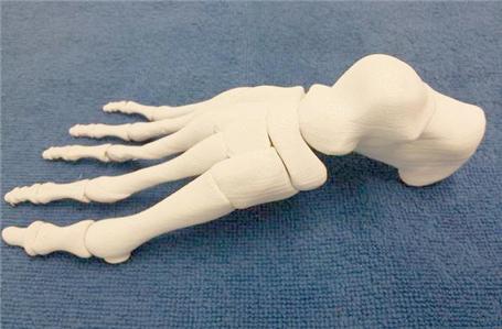 3D骨骼打印